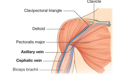 Shoulder Arthroscopy